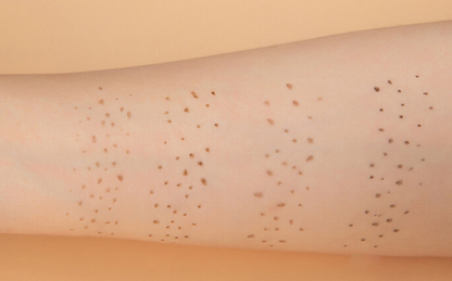 Scandinavian Beauties Freckle Pop