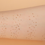 Scandinavian Beauties Freckle Pop