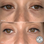 Scandinavianbeauties - Eye Glow Patches (2PCS) - Scandinavianbeauties